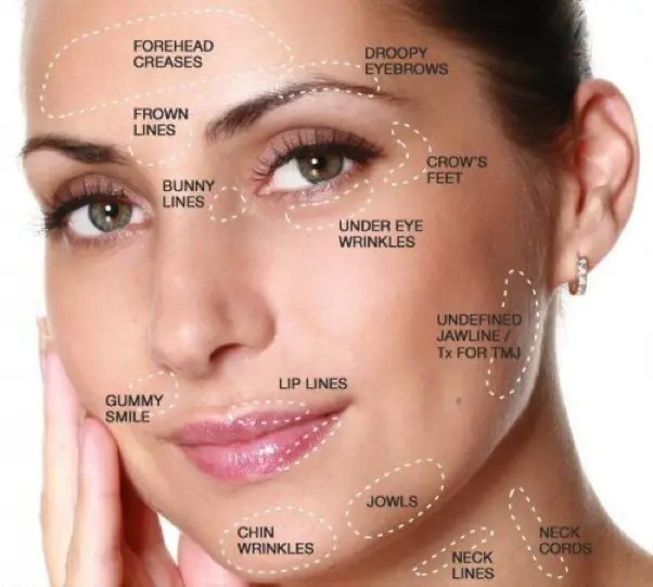 Botox & Wrinkle Relaxers at Palm Beach Advanced Aesthetics