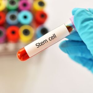 Stem Cell Therapy