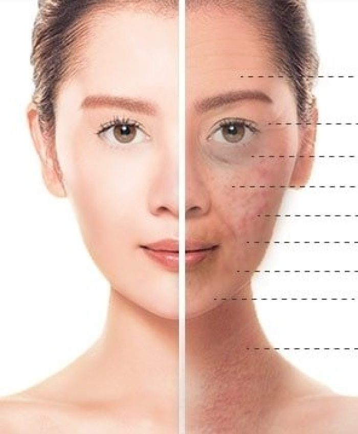 Unlock the Power of Pure Plasma: Revolutionary Skin Rejuvenation at Palm Beach Advanced Aesthetics