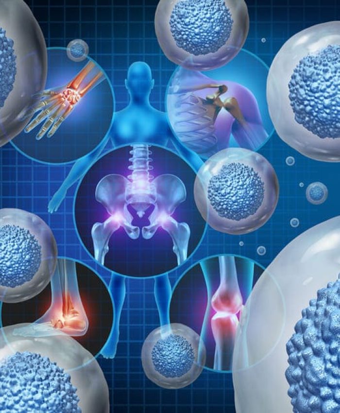 Unlock the Power of Regeneration: Stem Cell Therapy at Palm Beach Advanced Aesthetics
